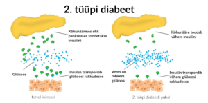 2. tüüpi diabeet