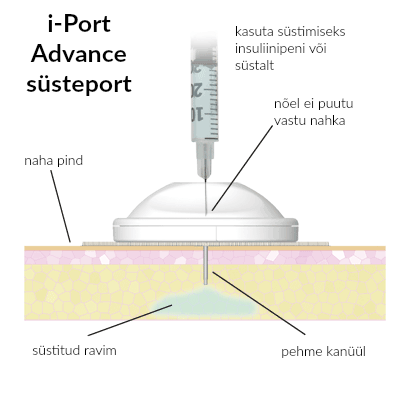 i-port advance süsteport
